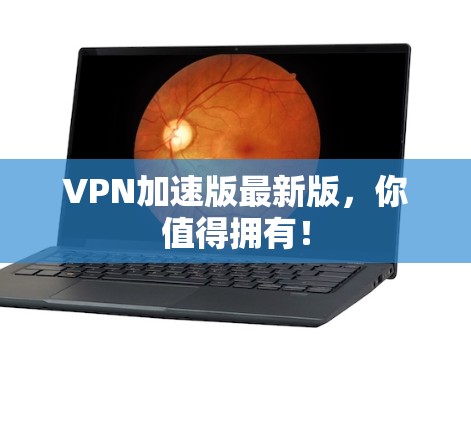 VPN加速版最新版，你值得拥有！